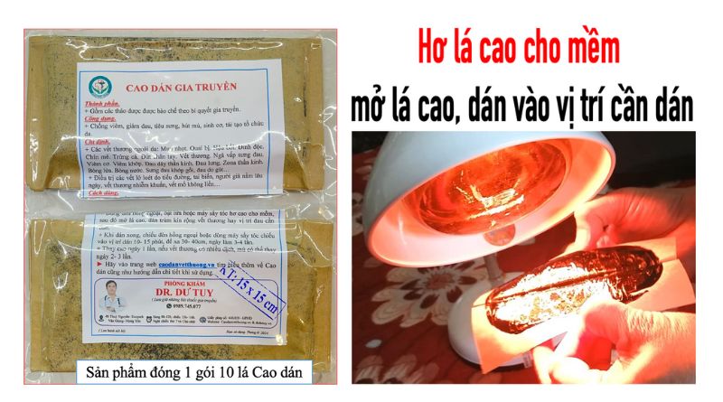 Hình ảnh vết thương bị nhiễm trùng